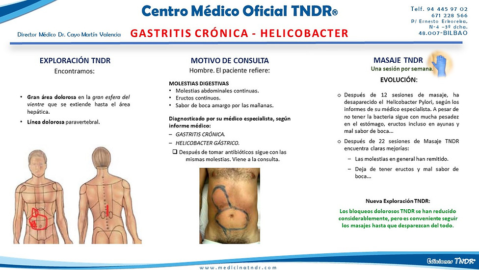 Gastritis_Crónica.jpg