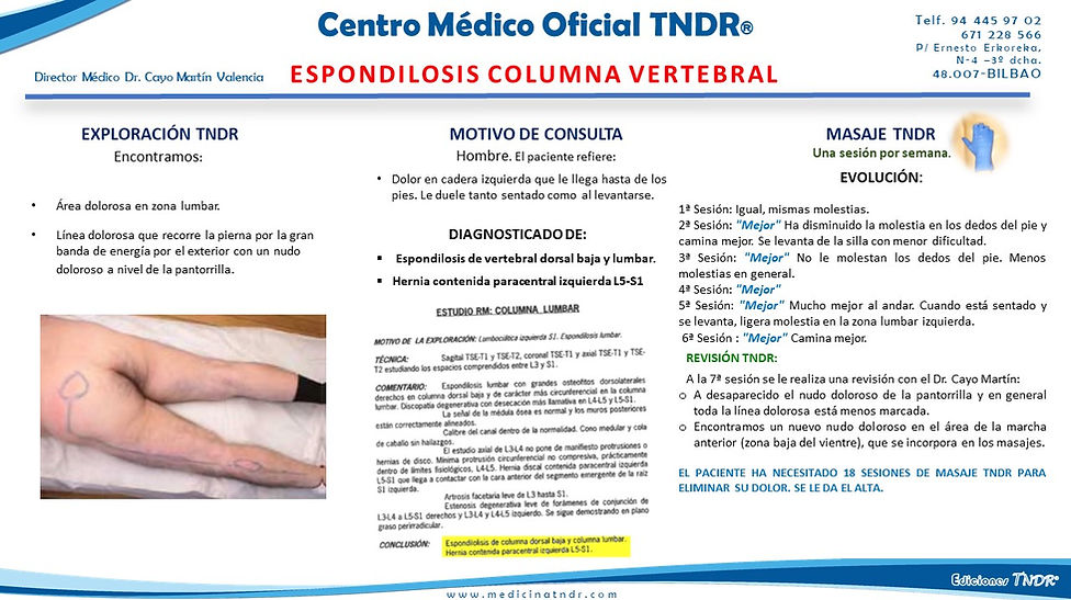 Caso Clínico Dolor en Coccix