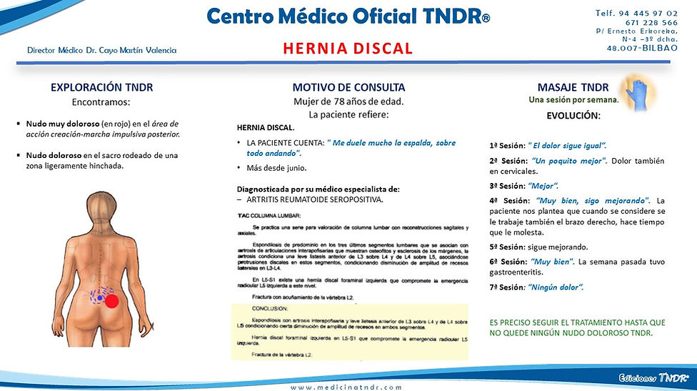 Hernia Discal-.jpg