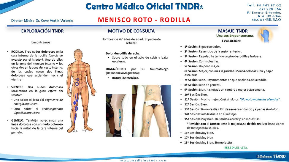 Menisco roto - Rodilla.jpg