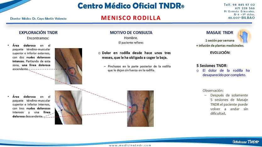 MENISCO RODILLA.jpg