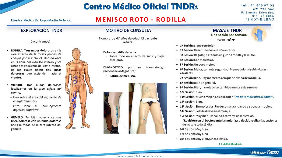 Menisco roto - Rodilla.jpg