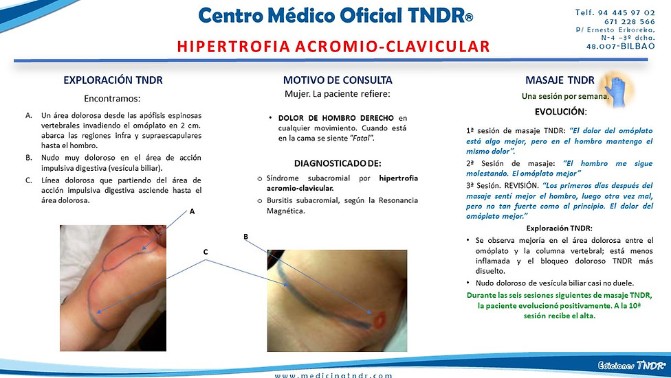 Caso Clínico Dolor en Coccix