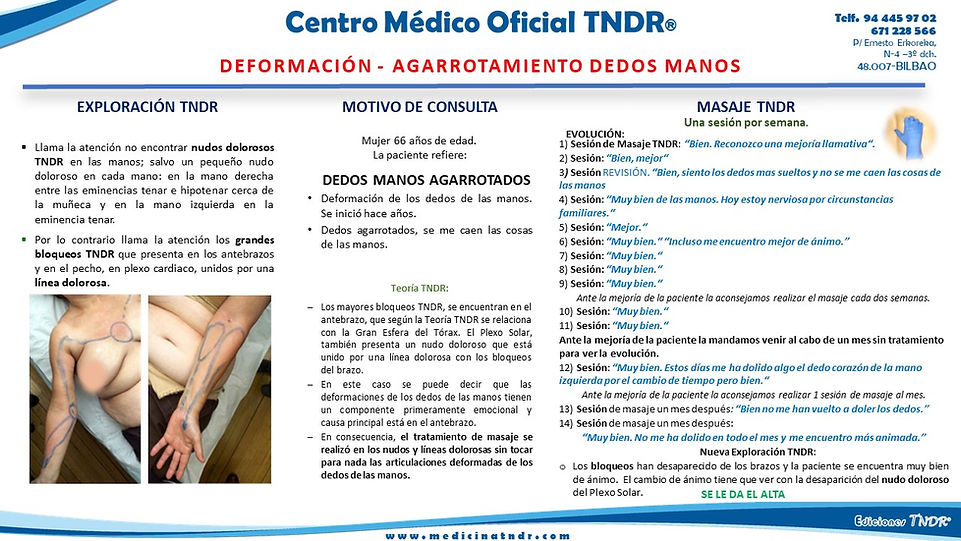 Deformación_Dedos_Manos.jpg