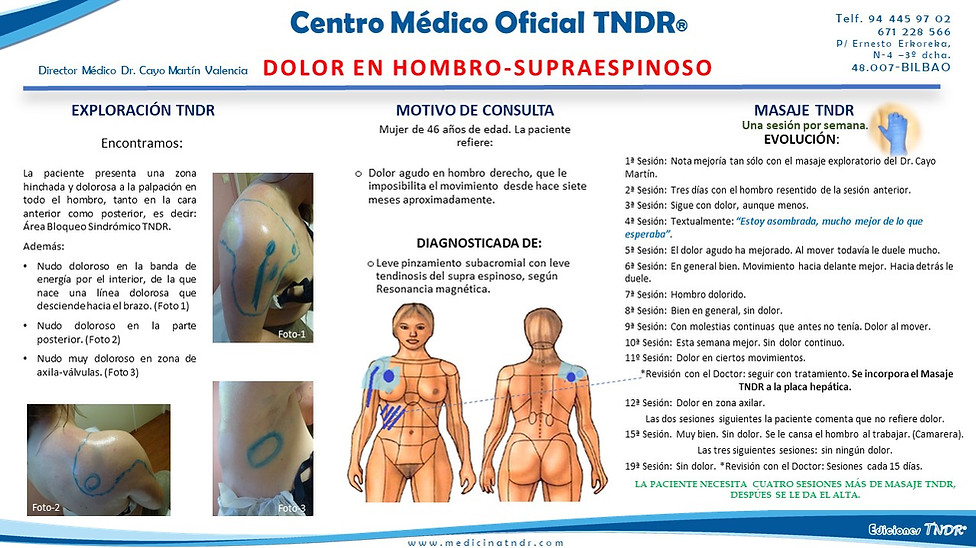 Caso Clínico Dolor en Coccix