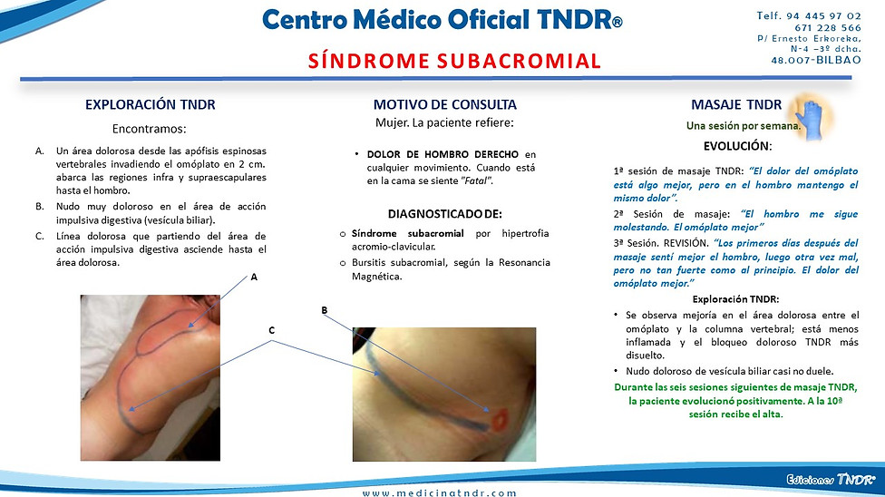 Caso Clínico Dolor en Coccix
